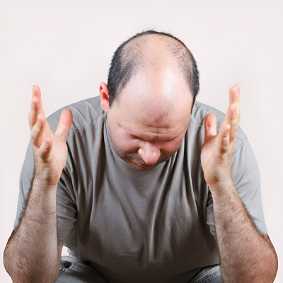 Can Stress Cause Hair Loss?