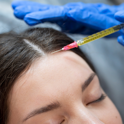 PRP Hair Treatment Cost in Islamabad