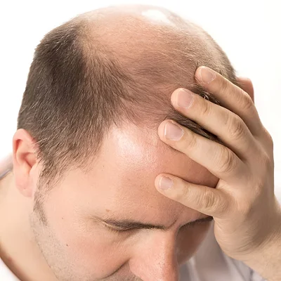 Can lose hair grow back?