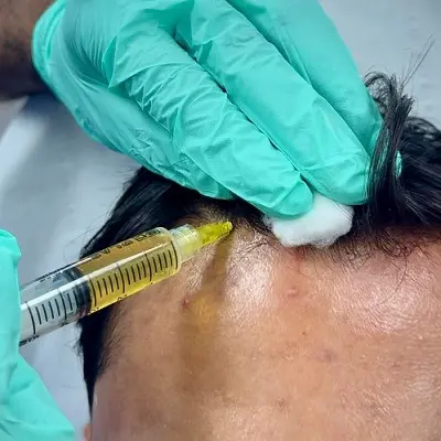 Korean vs American Exosomes, Which One Is The Best