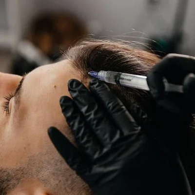Is Hair Regrowth Possible with Exosome Therapy
