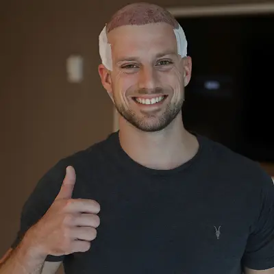 Top Hair Transplant Clinic in Islamabad for Natural Results