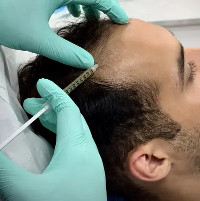 At what stage is PRP no longer effective